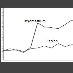 Low risk time* intensity curve