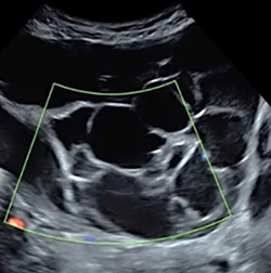 Irregular (i.e. not smooth)