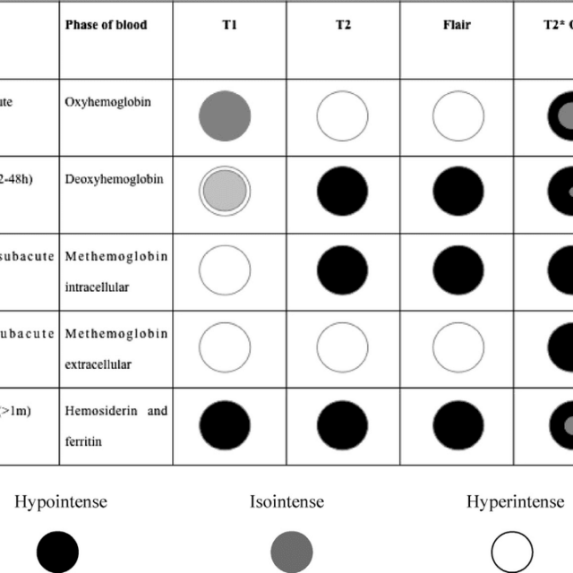 Appearance of intracerebral hemorrhage on MRI by stage
